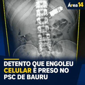 DETENTO QUE ENGOLEU CELULAR É PRESO NO PSC DE BAURU